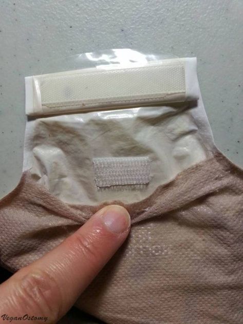 Hollister Ostomy Pouch Hack - OSTOMY TIP (w/ video) | VeganOstomy Ostomy Fashion, Ostomy Life, Ostomy Supplies, Neat Tricks, Save You, New Life, Hollister, Pouch, How To Apply