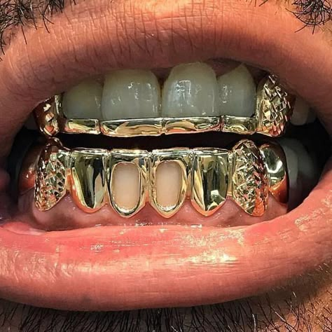 Gold Teeth Grills, Teeth Grills, Teeth Gems, Pretty Teeth, Dental Jewelry, Grillz Teeth, Diamond Grillz, Gold Grill, Custom Grillz