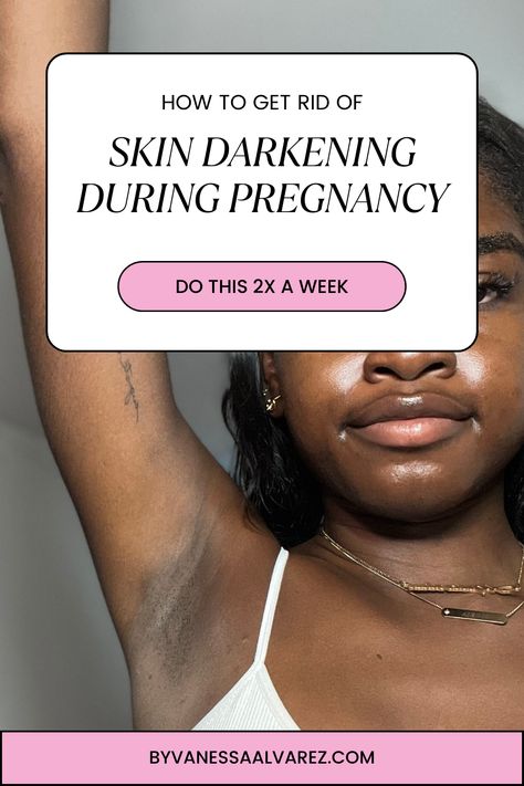 Home Remedies To Deal With Skin Darkening During Pregnancy Body Hyperpigmentation, Body Acne Remedies, Rid Of Dark Underarms, Hyperpigmentation Remedies, Skin Darkening, How To Fade, Pregnancy Skincare, Healthy Life Hacks, Pregnancy Labor