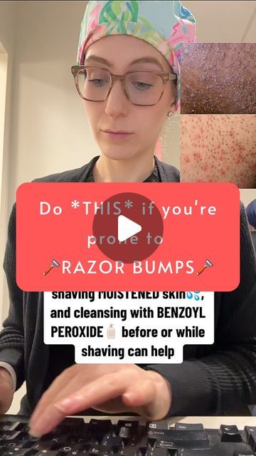 Heather Kornmehl, MD FAAD on Instagram: "❓DO YOU GET FRUSTRATED BY RAZOR BUMPS❓

⭐️Razor bumps are also known as "Pseudofolliculitis barbae". They are more common in individuals who closely shave curly hair. Closely shaving curly hair causes the hair to penetrate the wall of the follicle and pierce the surrounding skin as it grows in. This manifests as razor bumps/ ingrown hairs.

⭐️A sharp razor blade is more effective at removing hair initially, and makes you less likely to keep re-shaving the same area which contributes to razor bumps. Using a single blade also prevents the shave from being as close, and as mentioned above, closely shaving also contributes to razor bumps. Areas shaven are also at risk of bacterial superinfection. Benzoyl peroxide not only has antimicrobial properties, b How To Remove Razor Bumps, How To Prevent Razor Bumps, Shaved Curly Hair, Razor Bumps Remedy, Dark Armpits, Razor Bumps, Ingrown Hairs, Razor Burns, Benzoyl Peroxide