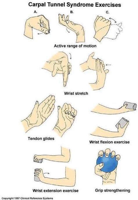 Carpal Tunnel exercise chart Carpal Tunnel Exercises, Carpal Tunnel Relief, Wrist Exercises, Hand Exercises, Hand Pain, Yoga Iyengar, Hand Therapy, Carpal Tunnel, Vinyasa Yoga