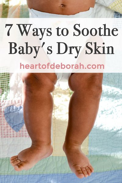 Is your baby prone to dry skin? How often should you be moisturizing? Read how to defeat dry skin and soothe your baby's skin with these 7 simple tips! Newborn Skin Peeling, Newborn Dry Skin, Dry Peeling Skin, Baby Dry Skin, Baby Moisturizer, Extremely Dry Skin, Itching Skin, Dry Skin On Face, Dry Skin Remedies