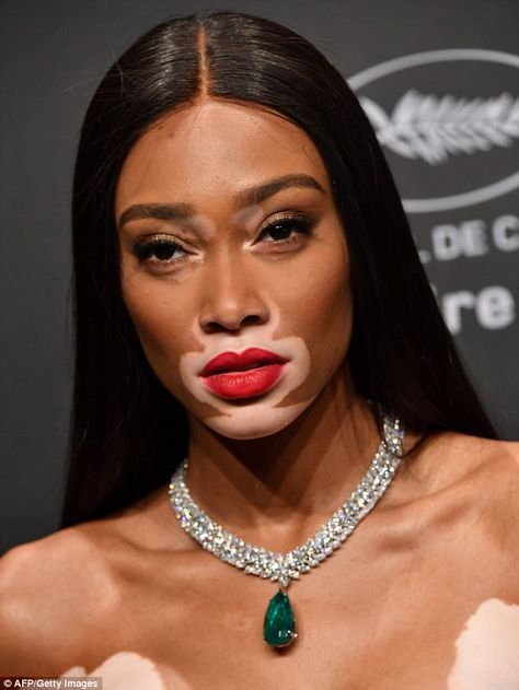 This is my moment: Winnie has become a household name in the fashion industry after findin... Chantelle Brown Young, Winnie Harlow, Happy Bday, Model Face, Luxury Makeup, Red Lipstick, Fenty Beauty, Huda Beauty, Kendall Jenner