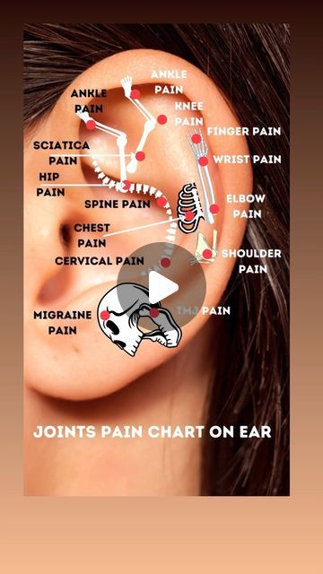 Dr. Aadil Khan on Instagram: "Ear acupuncture points have been widely known to relieve the pain associated with this physical issue. Acupuncture points on the ears may help relieve pain and tension around the body. Activating pressure points in the ear may help ease symptoms of several conditions.  #ear #auricular #acupuncture #acupressure #health #pain #organschart #organspoint #jointpain #ankle #shoulder #migraine #tmj #chest #wrist #ankle #knee #sciatica #cervical #acupuncturistaadilkhan   Disclaimer: This content is for educational purposes only and is not a substitute for professional medical advice. Please consult a doctor for any health concerns.  Disclaimer: Reposting this content without permission is prohibited. Please contact us for authorization." Ear Acupressure Points Migraine, Ear Health Tips, Ear Acupuncture Points, Ear Acupressure Points, Auricular Acupuncture, Body Pressure Points, Painful Pimple, Ear Acupuncture, Ear Seeds