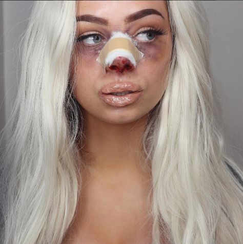 Bad Plastic Surgeries, Halloweenský Makeup, Plastic Surgery Photos, Nose Surgery, Image Instagram, Reconstructive Surgery, Halloween Makeup Tutorial, Nose Job, Halloween Make Up