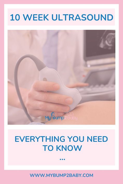 10 Week Ultrasound – Everything You Need to Know. 10 Week Ultrasound Pictures, 10 Week Ultrasound, Pregnancy Symptoms By Week, Nausea Pregnancy, Ultrasound Pictures, Pregnancy Signs, Pregnancy Symptoms, Pregnancy Week By Week, Pregnancy Tips