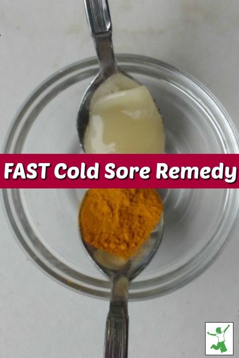 Cold sores or fever blisters, most people get them. There are some wonderful natural remedies to help with the cold sores. Come find out about three fast cold sore remedies that you could be using today! #coldsores #coldsoreremedies #coldsoreremedy #feverblisters #feverblisterremedy #feverblisterremedies #naturalremedies #mrsjonescreationstation Cold Sore Remedy Fast, Heal Cold Sores Fast, Cold Remedy Tea, Fever Blister Remedy, Cold Sore Remedies, How To Heal Blisters, Natural Cold Sore Remedy, Home Remedies For Cold, Home Remedies For Fever