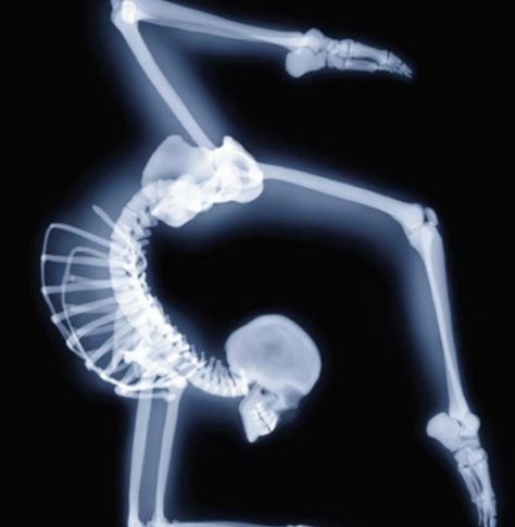 Awesome Dance Movement, Iyengar Yoga, A Skeleton, Dance Life, Lets Dance, Dance Art, Just Dance, X Ray, Dance Moms