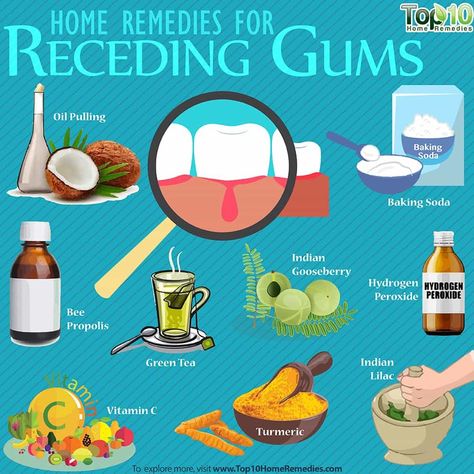 Top 10 Home Remedies, Gum Recession, Teeth Health, Gum Care, Receding Gums, Oil Pulling, Gum Health, Cold Home Remedies, Sleep Schedule