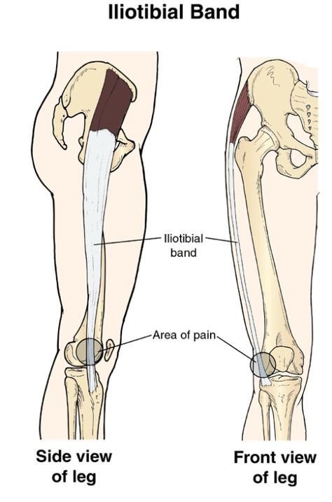 iliotibial band syndrome 1 Iliotibial Band Stretches, Quad Strengthening, Iliotibial Band, Knee Ligaments, Runners Knee, Ligament Injury, Home Exercise, Lower Extremity, It Band