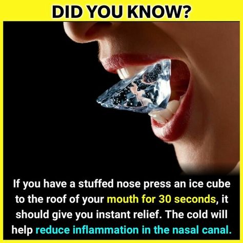 The 'Facts Encyclopedia' Instagram Is Dedicated To Sharing Unknown Facts Daily, Here're 40 Of The Most Fascinating Ones Unbelievable Facts Did You Know, Clogged Nose, Heart Facts, Unusual Facts, Strange Facts, True Interesting Facts, Cool Science Facts, Amazing Science Facts, Psychology Fun Facts