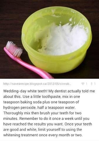 Get Whiter Teeth, Teeth Whitening Remedies, Teeth Whitening Diy, Diy Teething, Whiter Teeth, Best Teeth Whitening, Natural Teeth Whitening, Natural Teeth, Teeth Care