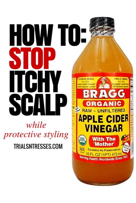 Stop Itchy Scalp, Itchy Scalp Remedy, Mehendi Course, Ogx Hair Products, Scalp Itch, Scalp Braids, Makeup Charts, Dry Itchy Scalp, Beauty Hacks Skincare