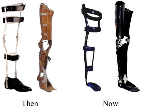 I wore the first model of brace until I was eighteen. Now I wear the last model. I was told I could have my knee fused together, so that it stayed straight all the time. Fusing my knee would be the only way I would ever get out of wearing a brace. Adaptive Devices, Leg Injury, Prosthetic Leg, Leg Braces, Leather Apron, Mobility Aids, Poor Posture, Knee Brace, Fitness Gifts