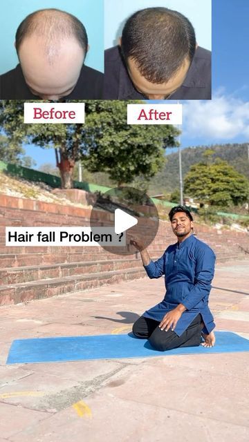 Yoga For Hair Fall Control, Hair Fall Remedy Home, Hair Fall Control Tips, Hair Fall Problem, Hair Fall Remedy, Hair Solution, Hair Fall Solution, Hair Care Remedies, Improve Nutrition