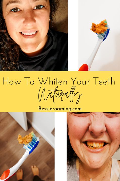 Whiten Teeth Naturally, Teeth Whiting At Home, Teeth Whitening Remedies, Teeth Whitening Diy, Dental Cavities, Whiten Teeth, Yellow Teeth, Teeth Health, Tooth Sensitivity