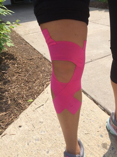 "Wrap it up" kinesiology tape. I have a partial tear in my meniscus from a sports injury a few years back. My knee gives me fits when I run and lift, with a loose feeling and minimal pain. This tape mad a substantial difference in my running and a complete fix in lifting. Highly recommend. Kt Tape Knee, Knee Taping, K Tape, How To Strengthen Knees, Kt Tape, Knee Problem, Kinesio Taping, Sports Tape, Kinesiology Taping