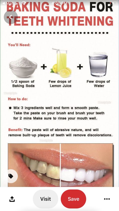 Baking Soda For Teeth, Brushing With Baking Soda, Hydrogen Peroxide Teeth, Low Carb Fast Food, Baking Soda Lemon Juice, Baking Soda Teeth, Baking Soda Shampoo Recipe, Lemon Juice Water, Teeth Whitening Homemade