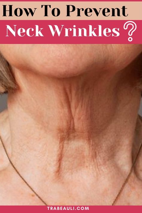 Neck wrinkles are a problem that happens to everyone at a certain age. Let's know the best ways to prevent them. Check out the blog- #neckwrinkles #homeremediesforwrinkles #wrinkles #skincare #skinproblems #remedy #preventneckwrinkles #getridofneckwrinkles Home Remedies For Wrinkles, Wrinkle Remedies, Brown Spots Removal, Neck Wrinkles, Skin Care Wrinkles, Skin Specialist, Flawless Face, Deep Wrinkles, Youthful Skin