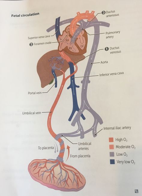 Fetal Blood Circulation Maternal Fetal Medicine, Fetal Circulation Flow Chart, Fetal Circulation Diagram, Fetal Circulation, Surgical Stitches, Newborn Nursing, Cardiac Sonography, Nursing School Life, Heart Diagram