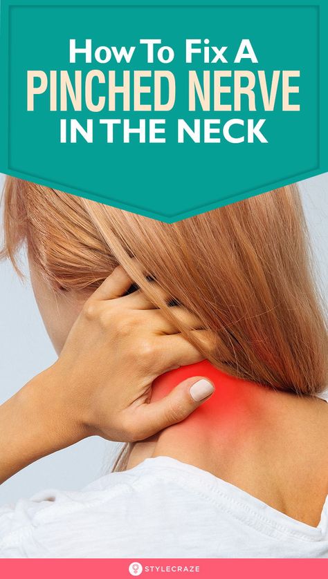 Pulled Neck Muscle, Knots In Neck Muscle, Crick In Neck, Pinched Nerve Relief, Pinched Nerve In Neck, Neck Sprain, Back Pain During Pregnancy, Stiff Neck Relief, Muscles Of The Neck