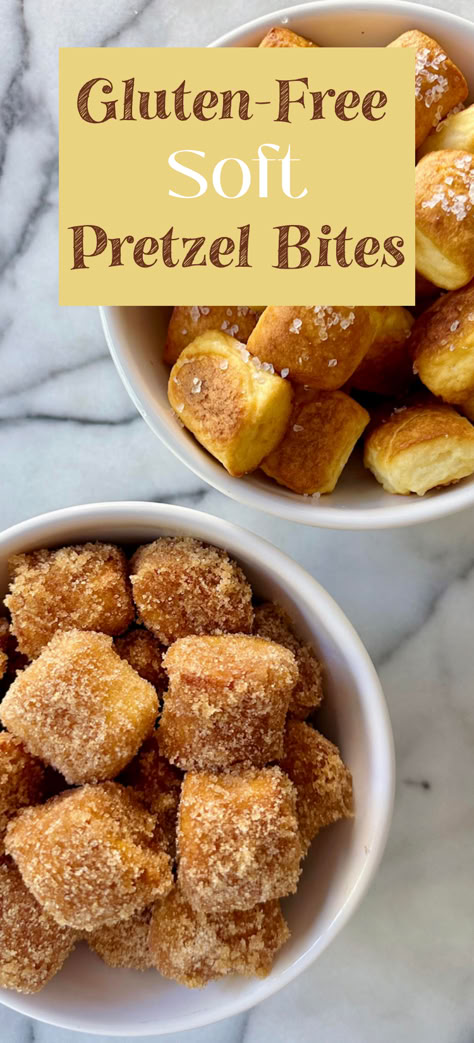 Gluten Free Soft Pretzels, Soft Pretzel Bites, Gluten Free Pretzels, Dairy Free Snacks, Easy Gluten Free Desserts, Gluten Free Appetizers, Soft Pretzel, Cookies Gluten Free, Gluten Free Bakery