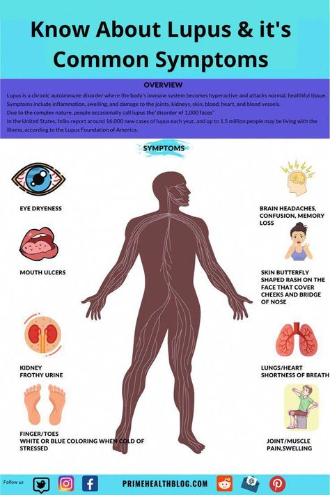 Lupus is a chronic autoimmune disorder where the body’s immune system becomes hyperactive and attacks normal, healthful tissue. Symptoms include inflammation, swelling, and damage to the joints, kidneys, skin, blood, heart, and blood vessels. Due to the complex nature, people occasionally call lupus the”disorder of 1,000 faces” #WhatIsMeaningOfOralCare #Nutrition Blood Heart, Nature People, Stronger Teeth, Oral Care Routine, Healthy Diet Tips, Autoimmune Disorder, Daily Health Tips, Oral Health Care, Fitness Advice