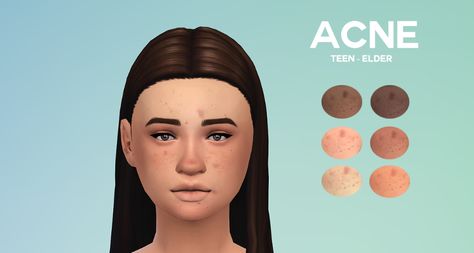 boredsimblr: Acne Now even your sims won’t have... - Fantayzia Maxis Match Ts4 Skin, Ts4mm Cc, Taemin Move, Sims Makeup, The Sims 4 Skin, The Sims 4 Pc, Skin Details, Sims 4 Cc Makeup, Sims 4 Mm Cc