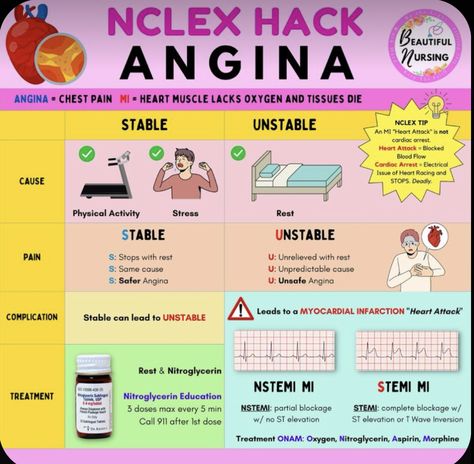 Nclex Lpn, Nclex Hacks, Nursing School Prep, Simple Nursing, Emt Study, Cardiology Nursing, Nurse Skills, Nursing School Inspiration, Paramedic School