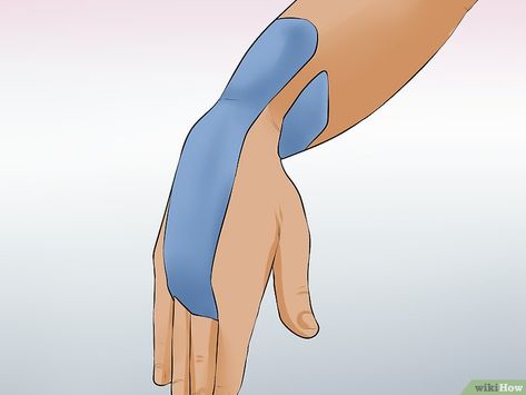 3 Ways to Wrap a Wrist for Carpal Tunnel - wikiHow Carple Tunnel, Carpal Tunnel Exercises, Carpal Tunnel Relief, Kt Tape, Median Nerve, Wrist Pain, Kinesio Taping, Hand Exercises, Hand Pain