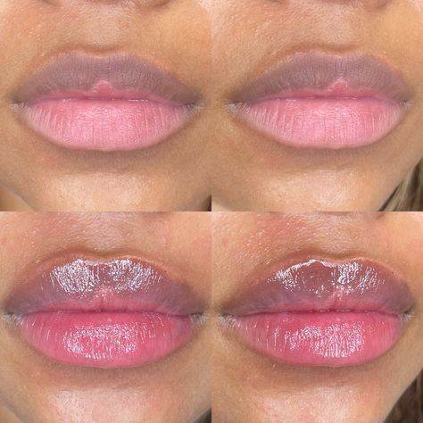 Lip filler before and afters by UPKEEP Med Spa. Find more juicy lip inspo and beauty aesthetics on our page or Instagram. Lip Filler Before And After Black Women, Lip Filler Black Women, Lip Fillers Before And After, Lip Fillers Before And After 1ml, Lips Goals, Lip Filler Before And After, Lip Filler Inspiration, Round Lips, Filler Inspiration