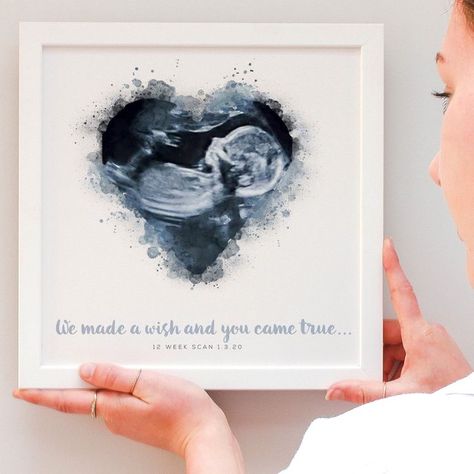 Baby Scan Frame, First Ultrasound, Vogue Kids, Baby Ultrasound, Idee Babyshower, Baby Scan, Baby Frame, Watercolour Illustration, Baby Room Design