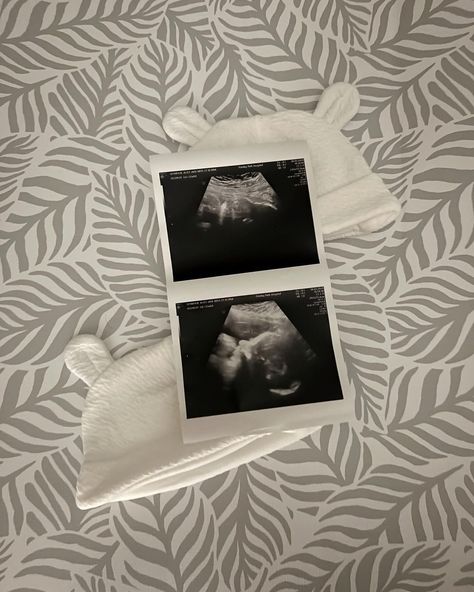 Another scan means another 2 weeks down and only one more scan to go🤯🤞🏼 the sonographer tried to get their profiles but they were hiding as per😂

Baby boys are both growing well and both now weigh roughly the same! Eeeek 🤍 I’ve brought tiny baby grows and now I’m wondering if they’ll fit 😂🫶🏻

Twin parents- I’m interested to know at what gestation you had your twins and what weight they were ⬇️👶🏼👶🏼

Thank you : @badleyboys_twins
•
•
•
•
• Twin Ultrasound 6 Weeks, Identical Twins Ultrasound, Twin Ultrasound, Twins Ultrasound, Baby Ultrasound, Twin Baby Girls, Baby Twins, Identical Twins, Twin Babies