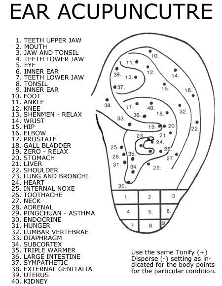 https://sourireetrespirer.wordpress.com/2020/08/27/ear-seeds/ Ear Acupressure Points, Ear Acupressure, Autogenic Training, Ear Reflexology, Ear Seeds, Ear Acupuncture, Shiatsu Massage Acupressure, Acupuncture Benefits, Reflexology Chart