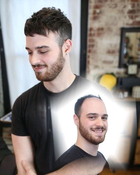 45 Men Before And After Getting Non Surgical Hair Replacements By Phil Ring Hair Pieces For Men, Hair Replacement For Men, Haircuts For Balding Men, Hair Replacement Systems, Luxurious Hair, Mens Wigs, Bald Men, Hair System, Hair Replacement