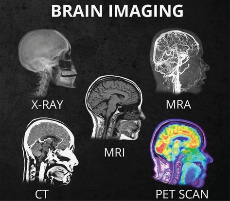 Home - San Diego Brain Injury Foundation Radiology Student, Brain Images, Pet Scan, Brain Facts, Medical Student Study, Brain Scan, Medical School Inspiration, Medical School Studying, Nursing School Notes