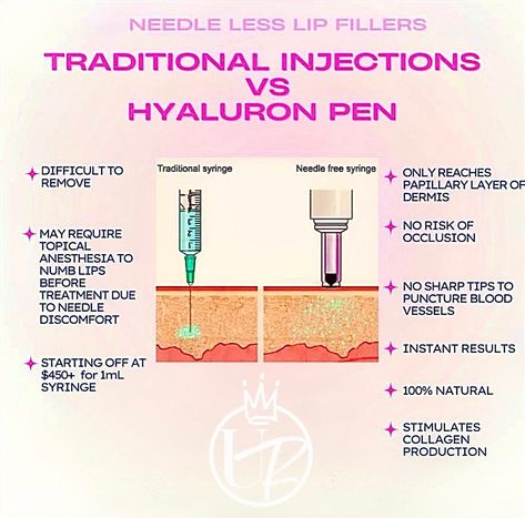 🫦 Traditional Fillers VS Hyaluronic Pen Lip Fillers 🫦 Hyaluronic Acid Filler is as natural as it comes & literally the best thing about getting filler with the pen is you can slowly build to the exact shape & volume you want without all the pain 🫶🏼 ❤︎︎ If You’re Scared Of Needles But Want A Lip Enhancement Then This Is The Procedure For You ! Process Only Takes 30-45 Minutes & Your Lips Will Instantly Look Plump ! ❤︎︎ ❣︎ 100% Natural ❣︎ Needle Free ! Non-Invasive Approach To Fuller & Smoot... Scared Of Needles, Hyaluronic Pen, Hyaluronic Acid Fillers, Lip Filler, Lip Enhancement, Lip Fillers, Body Contouring, Permanent Makeup, Hyaluronic Acid