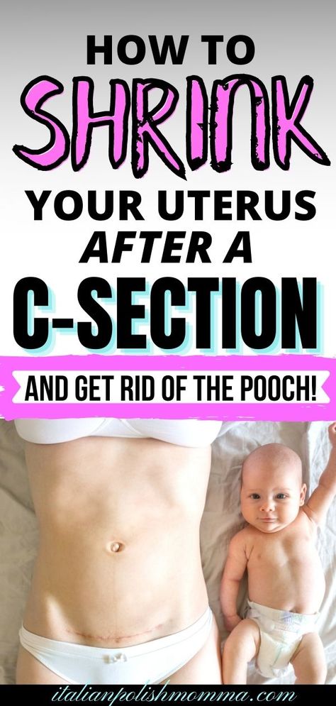 Want to know how to lose the c-section belly pooch and shrink your uterus fast? Find out how to shrink your uterus safely after birth and lose the c-section belly! Postpartum c-section tips from a mom that had 4 c-sections! | shrink uterus | postpartum belly | c-section recovery | c-section belly | C Section Pouch, C Section Belly, After C Section Workout, C Section Workout, Body After Baby, Loose Belly, Post Pregnancy Workout, Losing 40 Pounds, Belly Pooch