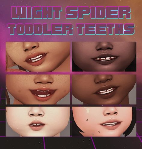 Sims 4 Default Teeth, Ts4 Teeth Preset, Sims 4 Default Teeth Replacement, Sims4 Cc Teeth, Sims 4 Toddler Skin Details, Teeth Cc Sims 4, Ts4 Teeth, Sims 4 Cc Grills Teeth, Sims 4 Cc Teeth