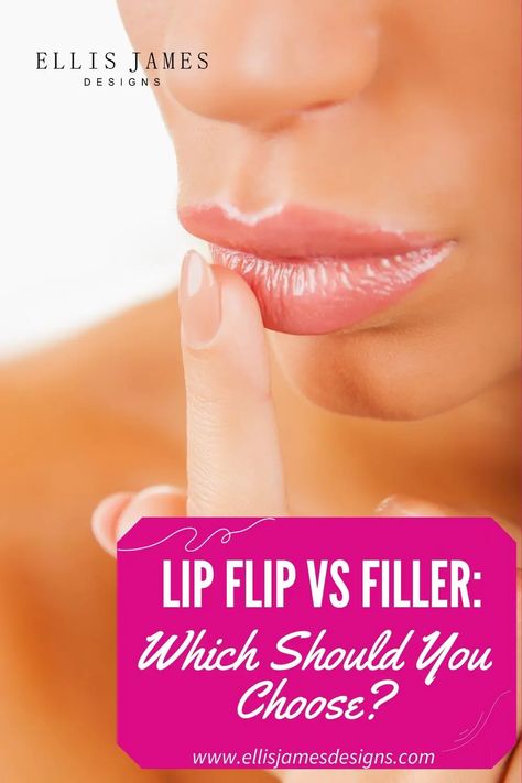 Lip Flip Vs Filler, Lip Flip, Cosmetic Procedures, Lip Fillers, Hard Time, You Choose, Life Hacks, Beauty Hacks, Lips