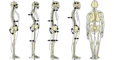 Because every human body is different and varies in shape, size and type, as well as muscularity, flexibility and fat-deposition patterns, it is not surprising that few people actually exhibit an “ideal” posture. There are various types of deviations from neutral spine position, which may be either temporary or permanent, and that can sometimes be alleviated through exercise. Punkty Spustowe, Posture Fix, Yoga Anatomy, Muscle Imbalance, Spine Health, Psoas Muscle, Lower Limb, Muscle Anatomy, Human Skeleton