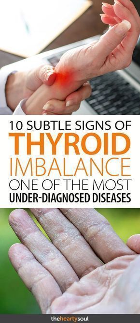 It’s estimated that as many as 25 million Americans have a thyroid problem, and half of them have no idea that they do. Hypothyroidism, or an underactive thyroid, accounts for 90% of all thyroid imbalances. The thyroid, a butterfly-shaped gland in the center of your neck, is the master gland of metabolism. How well your... Thyroid Imbalance, Hashimotos Disease, Thyroid Hormone, Thyroid Health, Adrenal Fatigue, Motivation Fitness, Muscle Pain, Health Info, Health Remedies