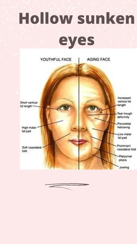 Face Aging, Workout Book, Sunken Eyes, Tear Trough, Nasolabial Folds, Face Yoga, January 13, Eye Area, Full Set