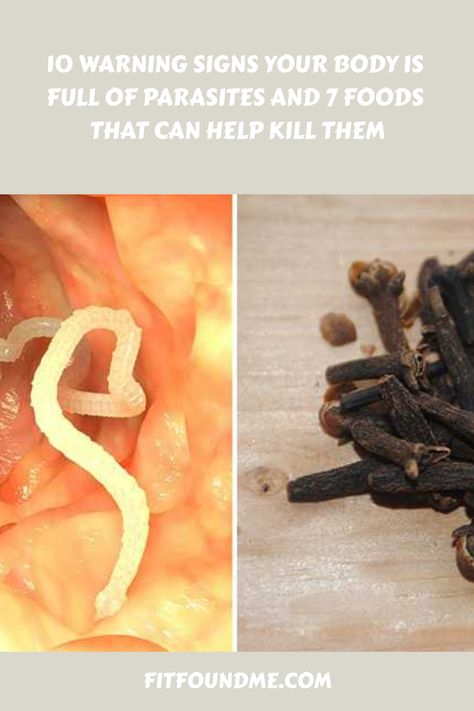 I don’t want to freak you out, but chances are YOU HAVE PARASITES. Yep, it’s true; about one third of Americans have parasites living in their digestive system. Are you shocked?! While this may surprise you, parasites are more common than you may realize. There are countless kinds of parasites that exist and many of … Skin Parasites, Internal Cleanse, 30 Min Meals, Parasite Cleanse, Oregano Oil, Food Poisoning, Stomach Problems, Chicken Bacon, Marjoram