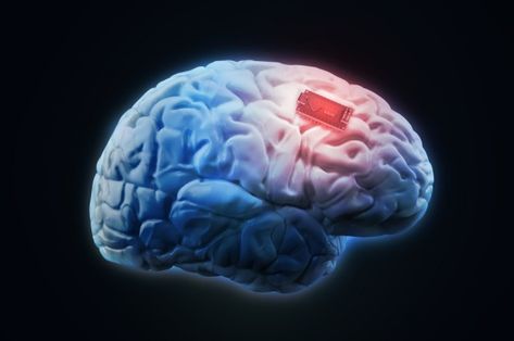 DARPA's Neural Interface Will Let Brains And Computers "Communicate" | IFLScience Deep Brain Stimulation, Human Memory, Brain Stimulation, Brain Tissue, World Economic Forum, Growth Factor, Disco Duro, Brain Activities, Emerging Technology