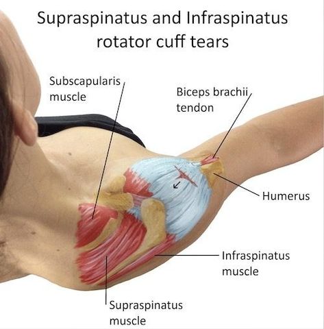 Biceps Brachii Muscle, Subscapularis Muscle, Infraspinatus Muscle, Rotator Cuff Pain, Punkty Spustowe, Shoulder Rehab Exercises, Shoulder Anatomy, Rotator Cuff Exercises, Rotator Cuff Surgery