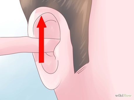 Ear Congestion Relief, How To Unplug Ears, Swimmers Ear Remedy, Relieve Ear Pressure, Unclog Ears, Ear Pressure Relief, Sinus Pressure Relief, Ear Congestion, Impacted Ear Wax