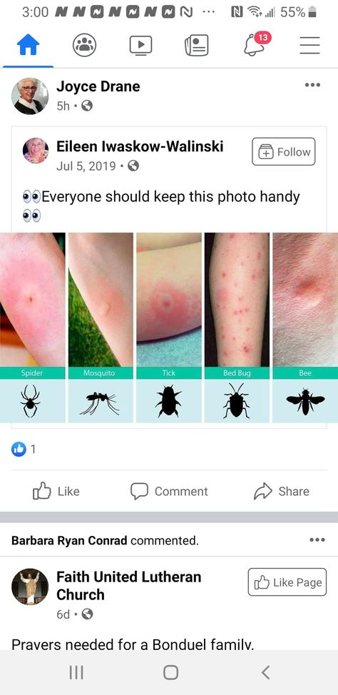 Types Of Bug Bites, Types Of Bellies, Bored List, Insect Identification, Funny Lock Screen Wallpaper, School Survival Kits, Types Of Bugs, Bed Bug Bites, Types Of Insects