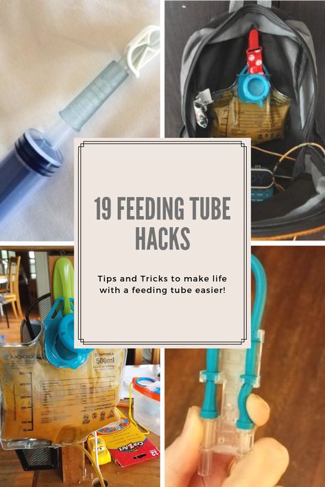 Are you new to tubie life and overwhelmed? Maybe you’re a long-time feeding tube user, but looking for some new ideas? These essential feeding tube hacks will make life with a feeding tube ju… Mickey Button Feeding Tube, Feeding Tube Accessories, Diy Feeding Tube Backpack, Ng Tube Baby Hacks, Tube Feeding Hacks, J Tube Feeding, G Tube Organization, Gtube Feeding Recipes, G Tube Feeding