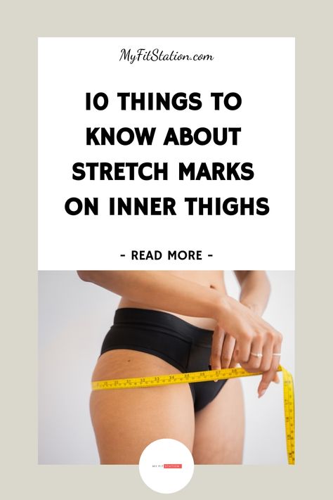 10 Things to Know About Stretch Marks on Inner Thighs How To Get Rid Of Purple Strech Marks On Thighs, How To Get Rid Of Strech Marks On Thighs, Stretch Mark Prevention Pregnancy, Inner Thigh Stretches, Stretch Mark Prevention, Stretch Mark Removal Cream, Strech Marks, Stretch Mark Remedies, How To Fade